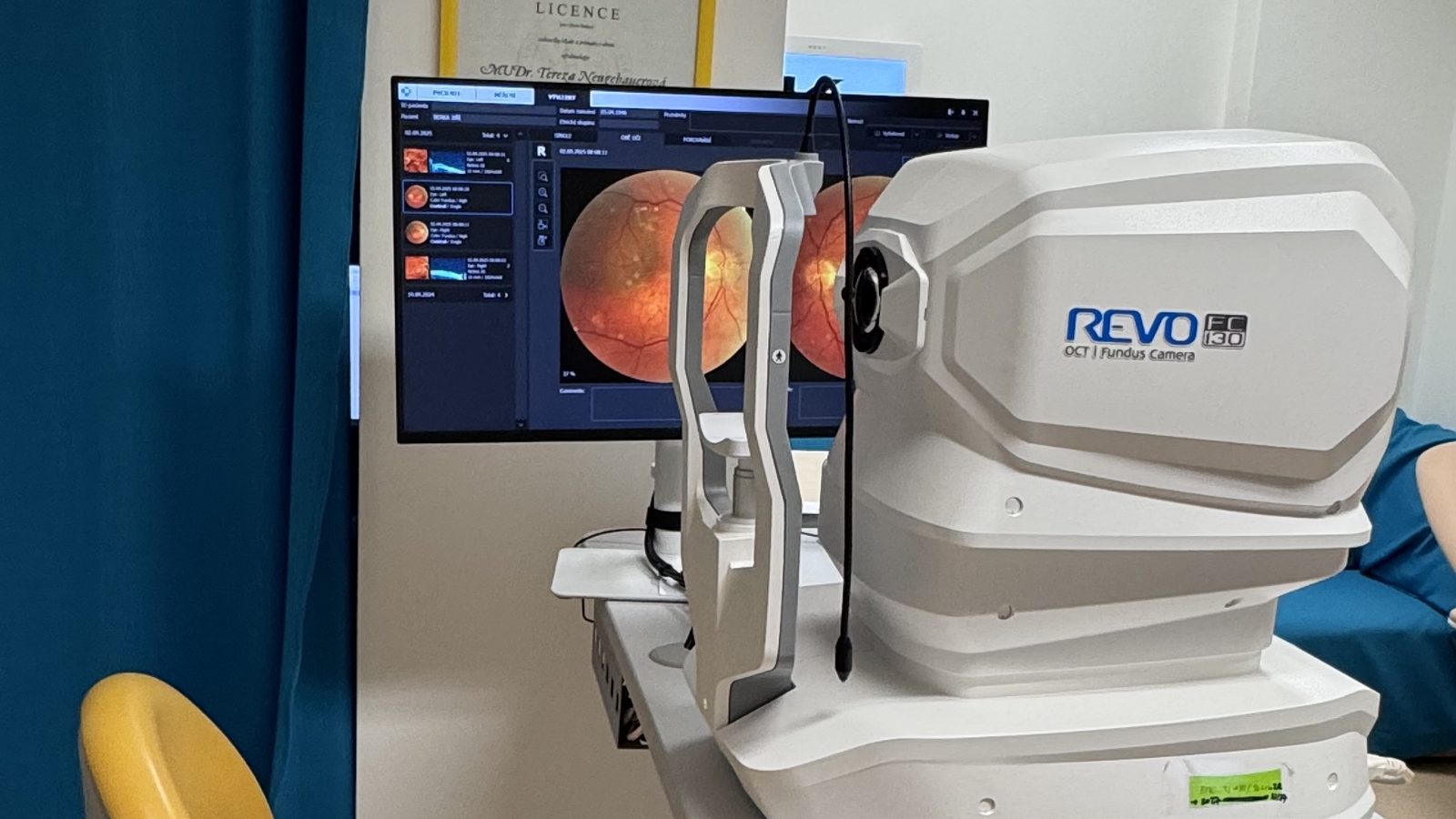 Přístroj REVO FC 130 — OCT a fundus kamera v naší ordinaci